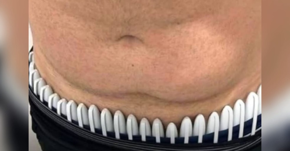 Medicamento para emagrecimento, que deve ficar armazenado sob refrigeração de 2°C a 8°C, estava sendo transportado irregularmente junto ao corpo do passageiro. — Foto: Reprodução