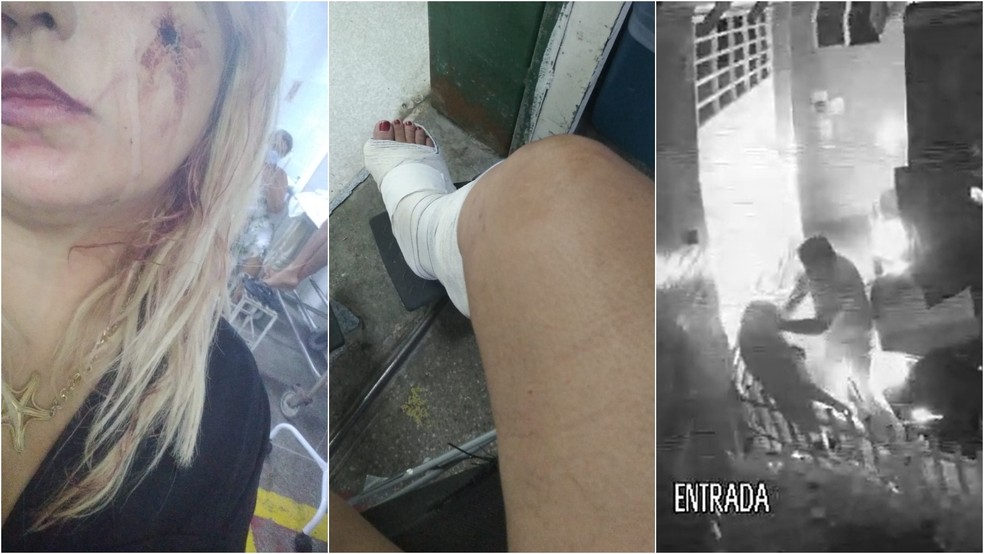 Mulher atropelada e agredida por homem em Fortaleza sofreu ferimentos na perna e no rosto — Foto: Reprodução