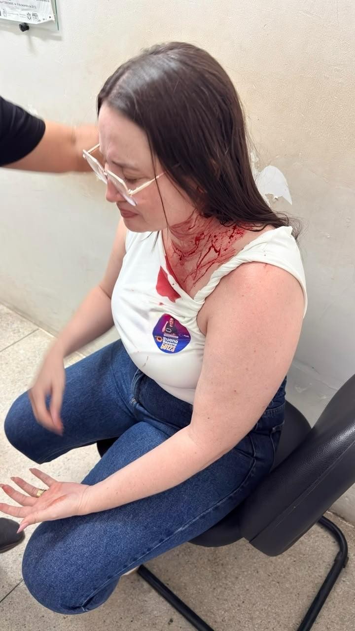 Candidata a deputada estadual em Pernambuco é atingida por pedra em caminhada no Sertão