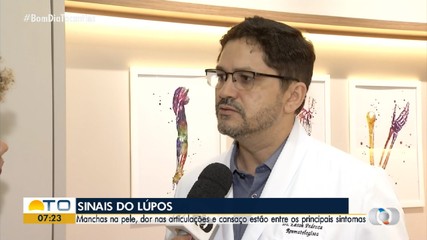Médico explica os sintomas e o tratamento do lúpus