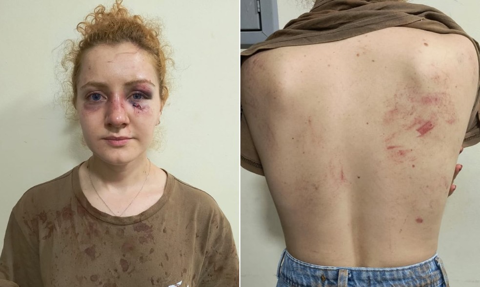 Polícia investiga homem, namorada e sogra por agredir jovem na Bahia — Foto: Redes Sociais