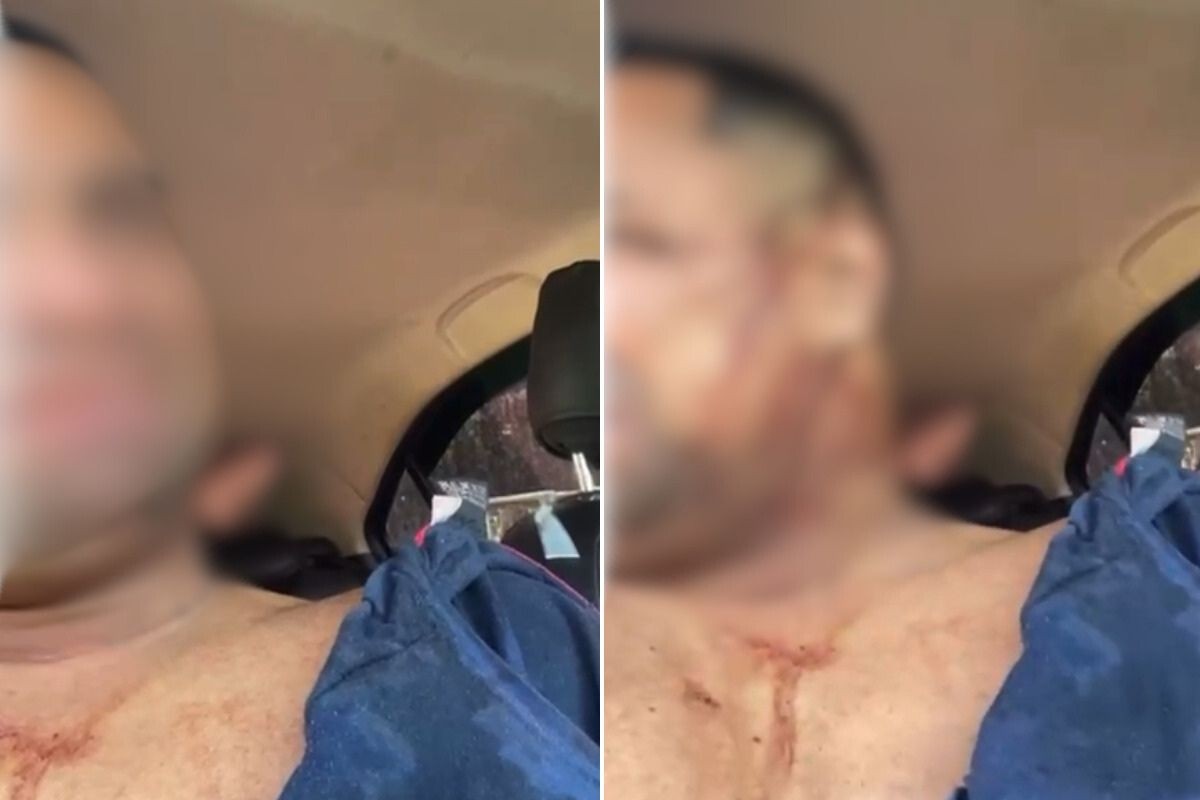 Motorista de app faz vídeo após ser baleado em sequestro; VEJA