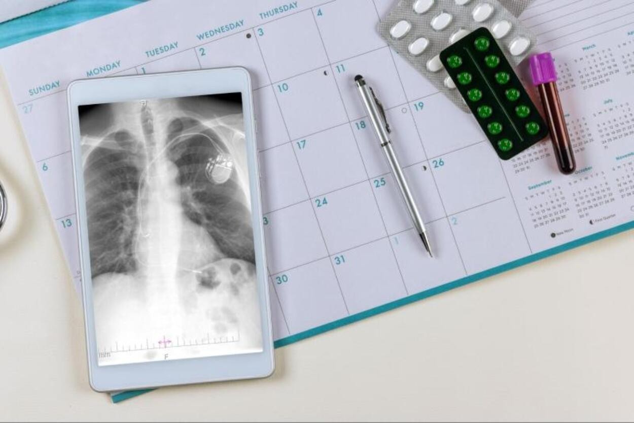 Medicamento inalável para tratar tuberculose é desenvolvido em pesquisa da Unesp Araraquara