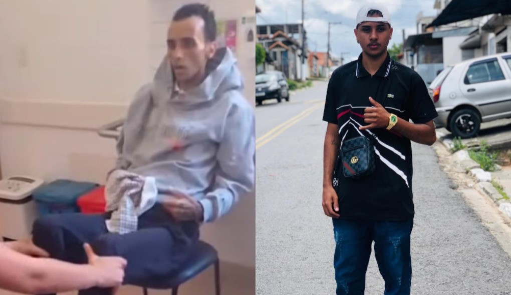 Após quase 10 meses de luta contra sequelas do metanol, jovem de 22 anos morre; família compartilhava 'diário' nas redes sociais