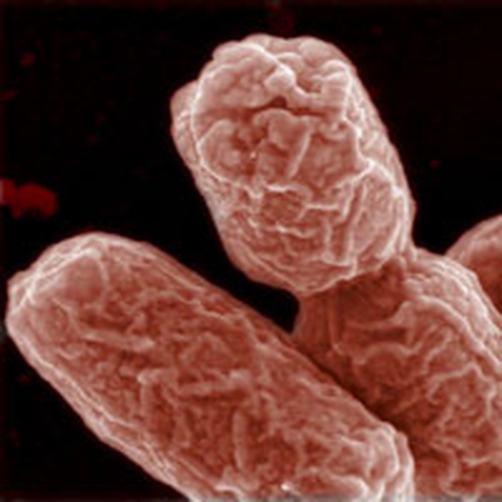 Exemplares da bactéria 'E. coli', vistos com microscopia eletrônica — Foto: Manfred Rohde / HZI / Reuters