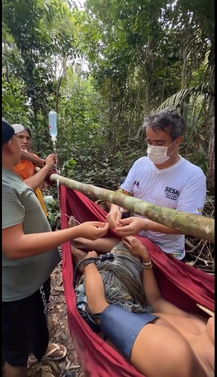 Indígena Zo'é é resgatado após ser atingido por flecha durante caçada no interior da Amazônia
