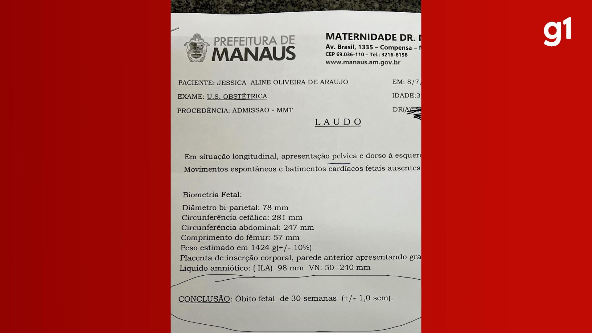 VÍDEO: Grávida relata que quase foi submetida a aborto de bebê vivo após erro em maternidade de Manaus