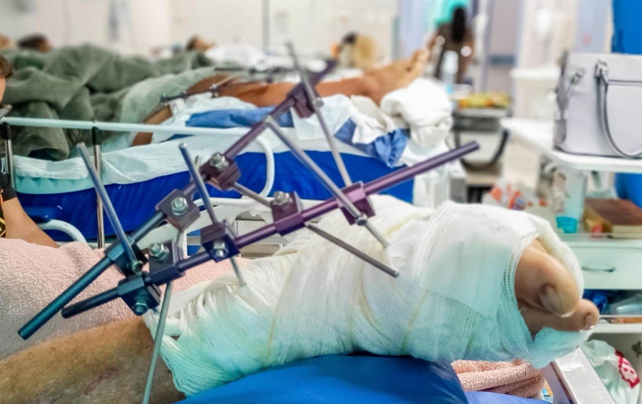 Manaus registra 288 vítimas de acidentes no feriadão; maioria sofreu queda de moto