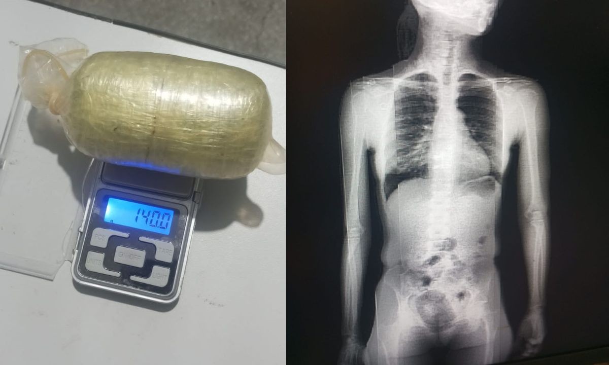 Mulher é presa após tentar entrar em presídio da BA com pacote drogas nas partes íntimas; raio-x mostra flagrante