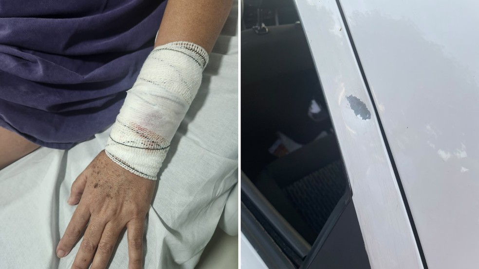 1 de 1
Mulher &eacute; atingida por bala perdida durante carreata em apoio a Lula em Bauru &mdash; Foto: Arquivo Pessoal/Divulga&ccedil;&atilde;o