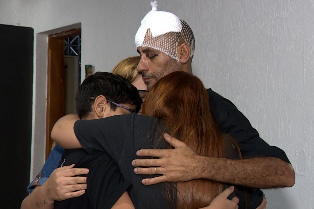 'Nasci de novo': baleado ao tentar impedir fuga de assaltantes ouviu do médico que espessura do osso da cabeça o salvou