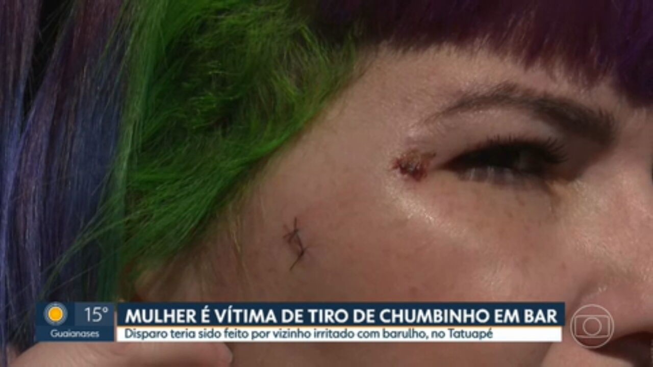 Mulher é atingida no rosto por bala de chumbinho em bar em SP; tiro teria sido disparado por morador de prédio vizinho
