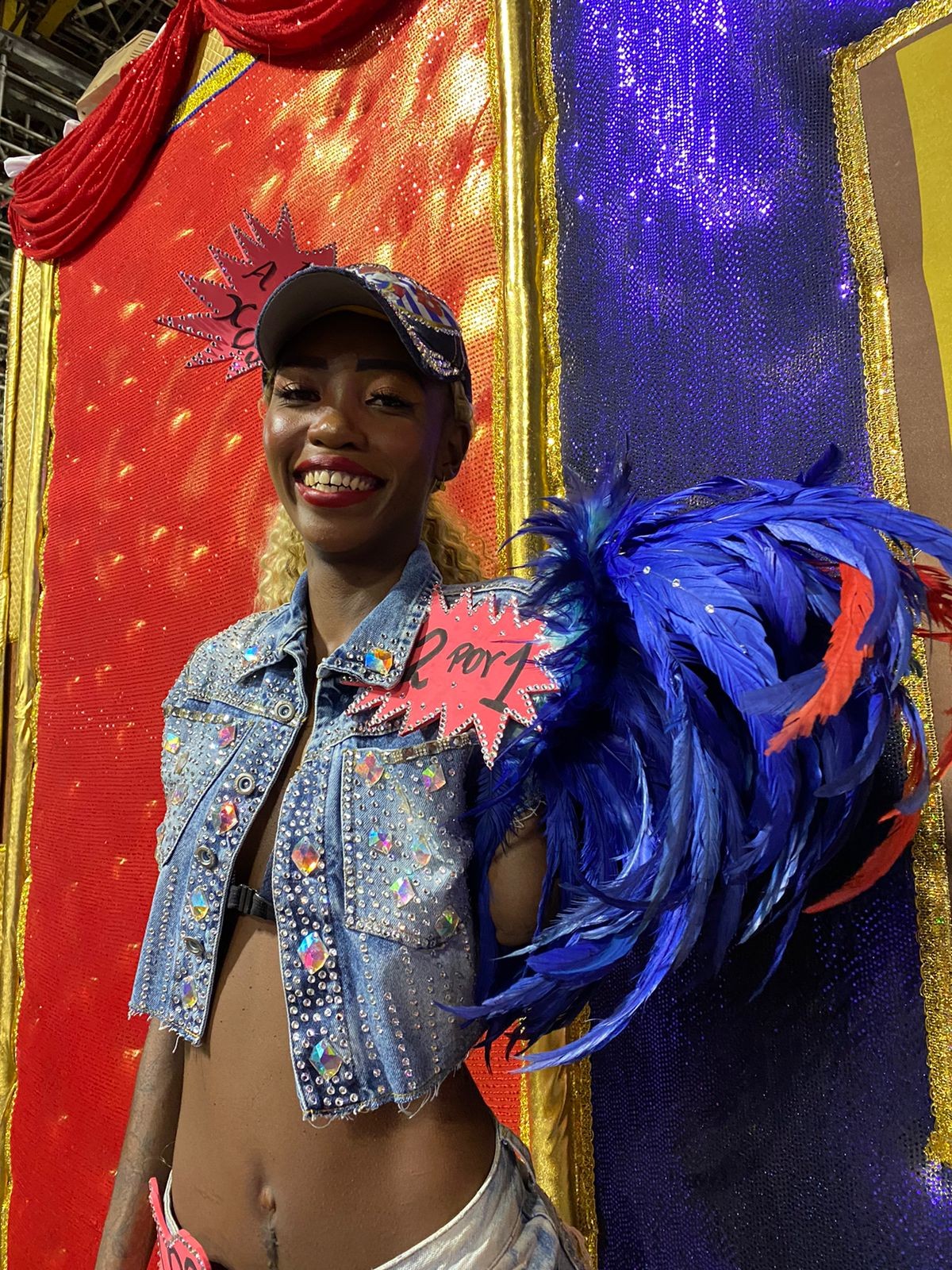 Passista que perdeu o braço após cirurgia de útero relata dificuldade financeira: 'Perdi minha profissão'