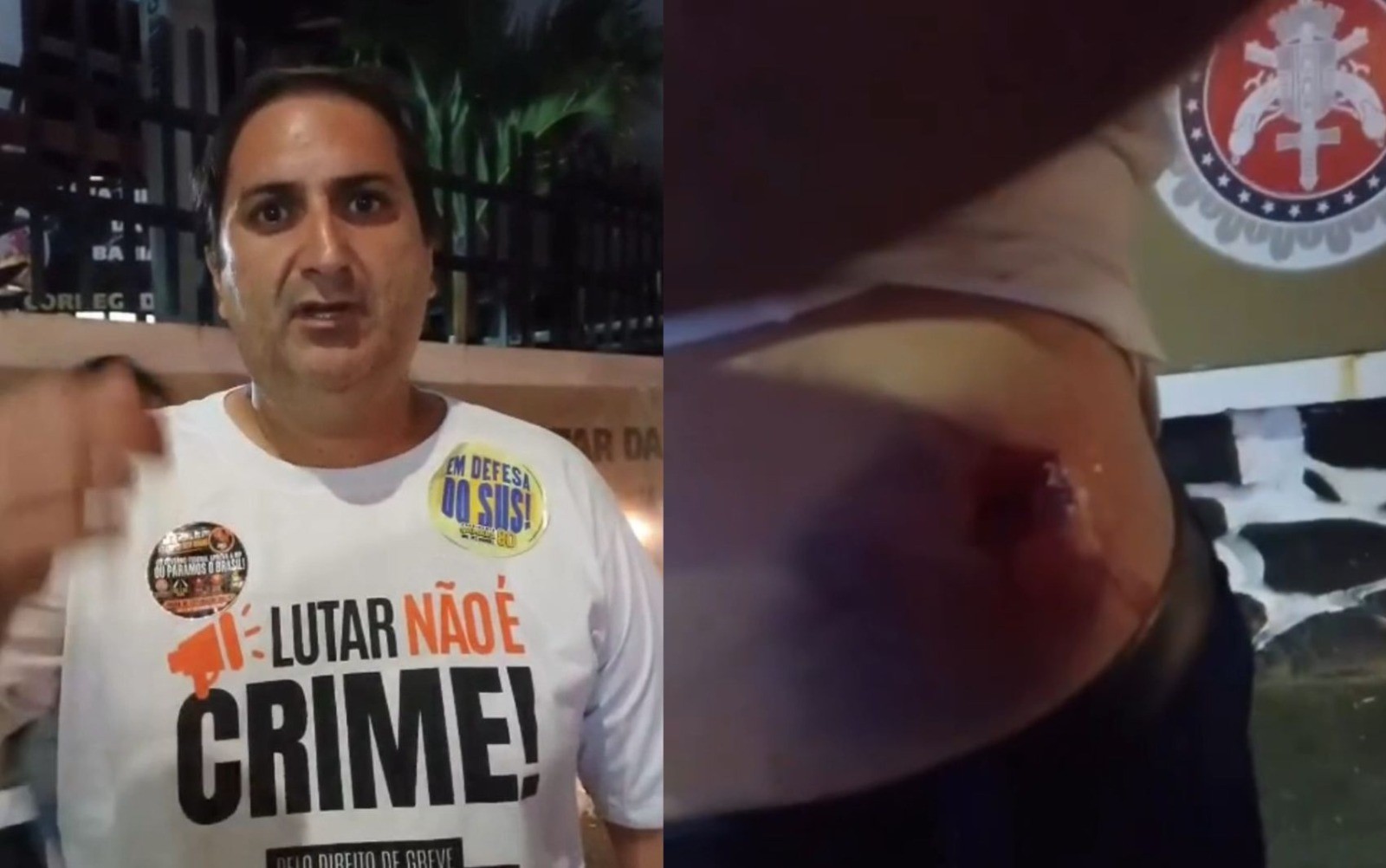 Candidato ao governo da Bahia é atingido por bala de borracha em protesto e acusa PM; vídeo mostra feridas