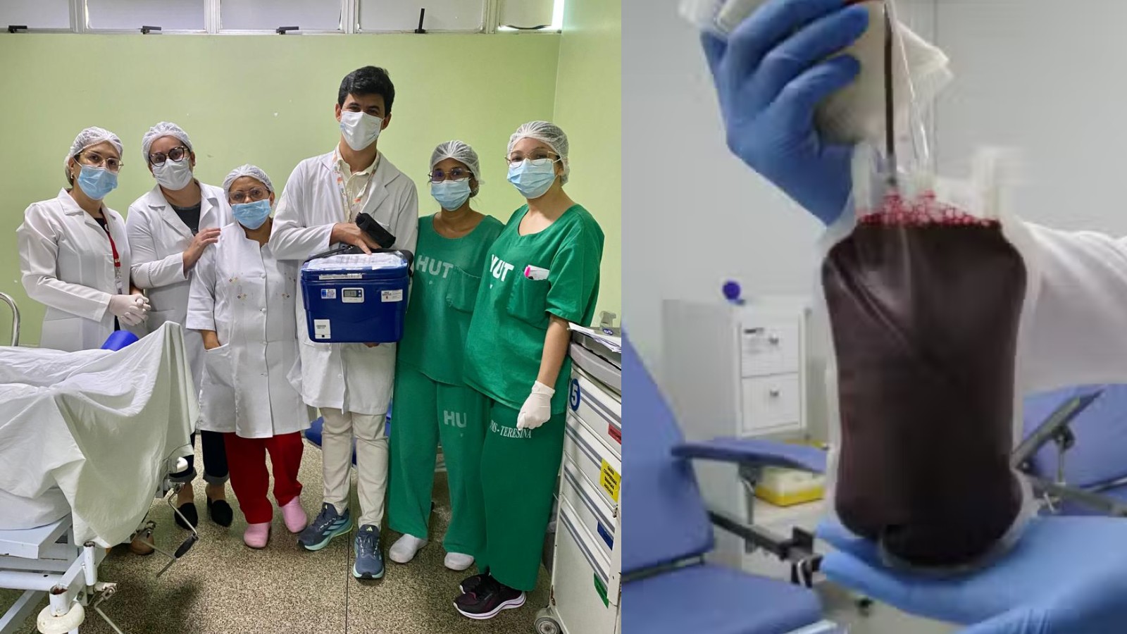 Hemopi mobiliza rede nacional para localizar sangue para paciente com combinação rara de anticorpos