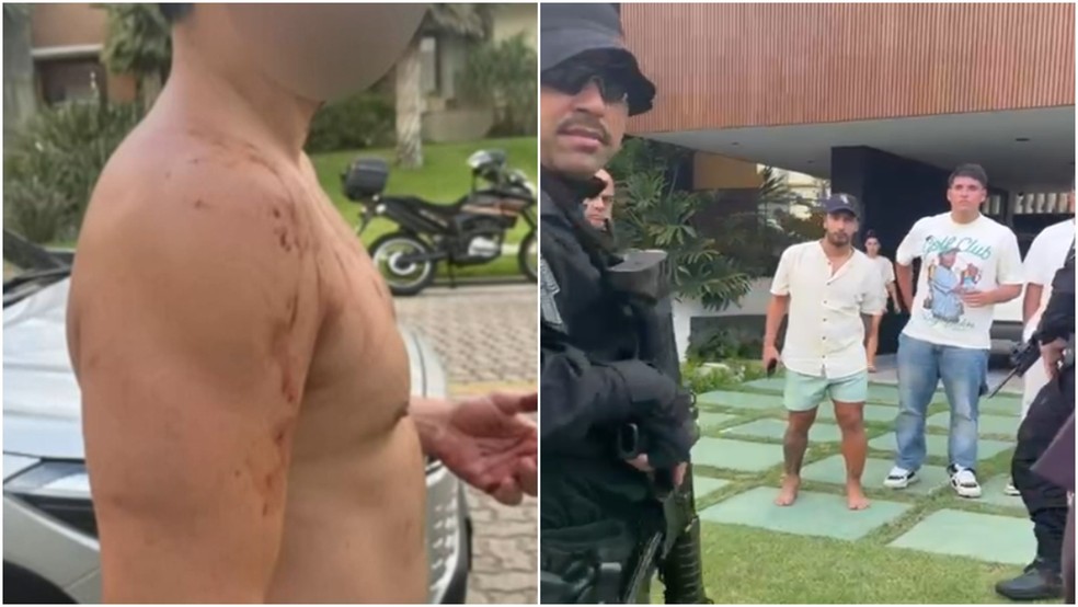 Homem diz ter sido agredido pelo jogador do Fortaleza Eros Mancuso — Foto: TV Verdes Mares/Reprodução