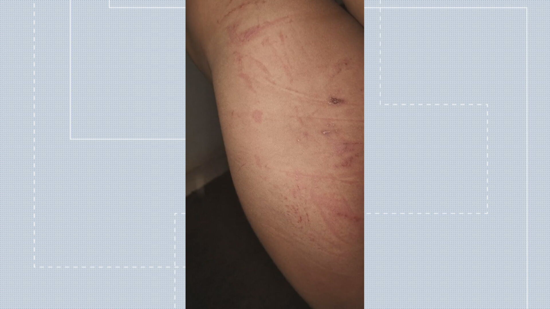 Criança de 6 anos chega em casa 'desorientada' e diz que bebeu álcool em sala de aula no DF