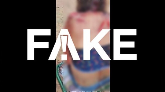É #FAKE que mulher ferida mostrada em vídeo foi atacada por onça