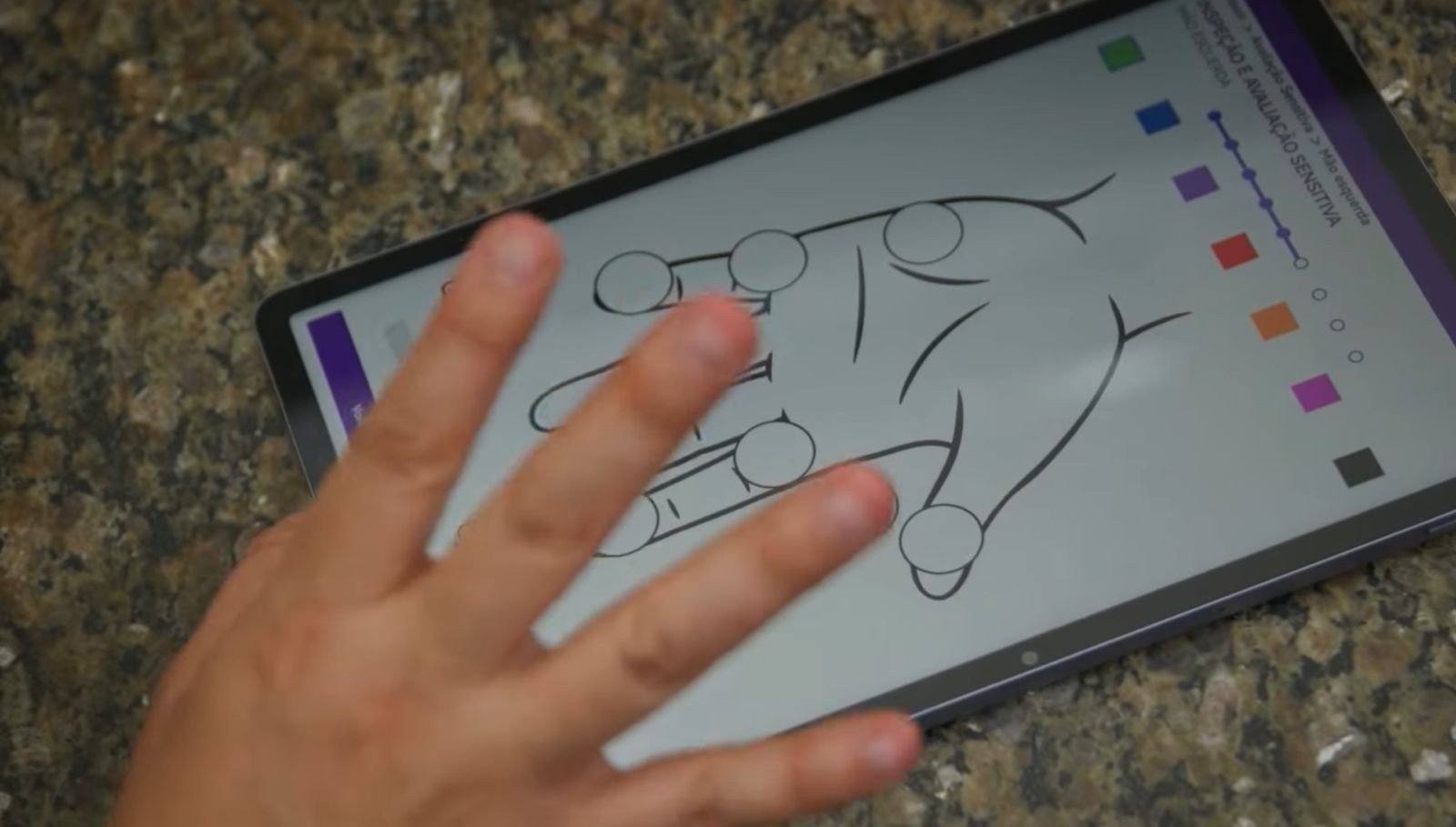 Pesquisadores criam app para agilizar exames de hanseníase e substituir fichas de papel em Pernambuco