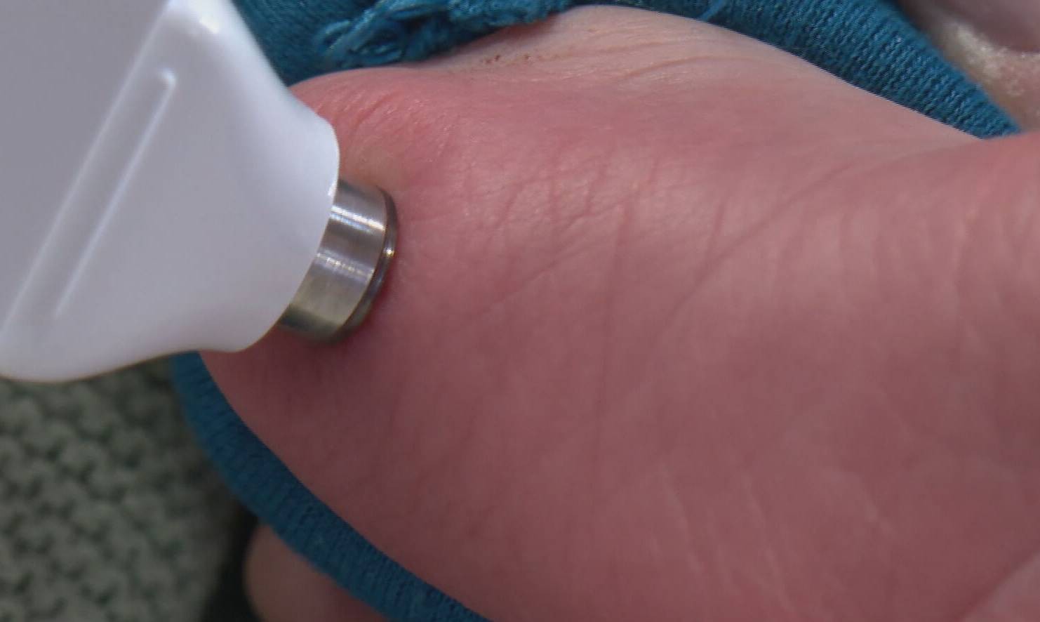 UFMG desenvolve aparelho que identifica tempo gestacional de recém-nascidos que não passaram por pré-natal