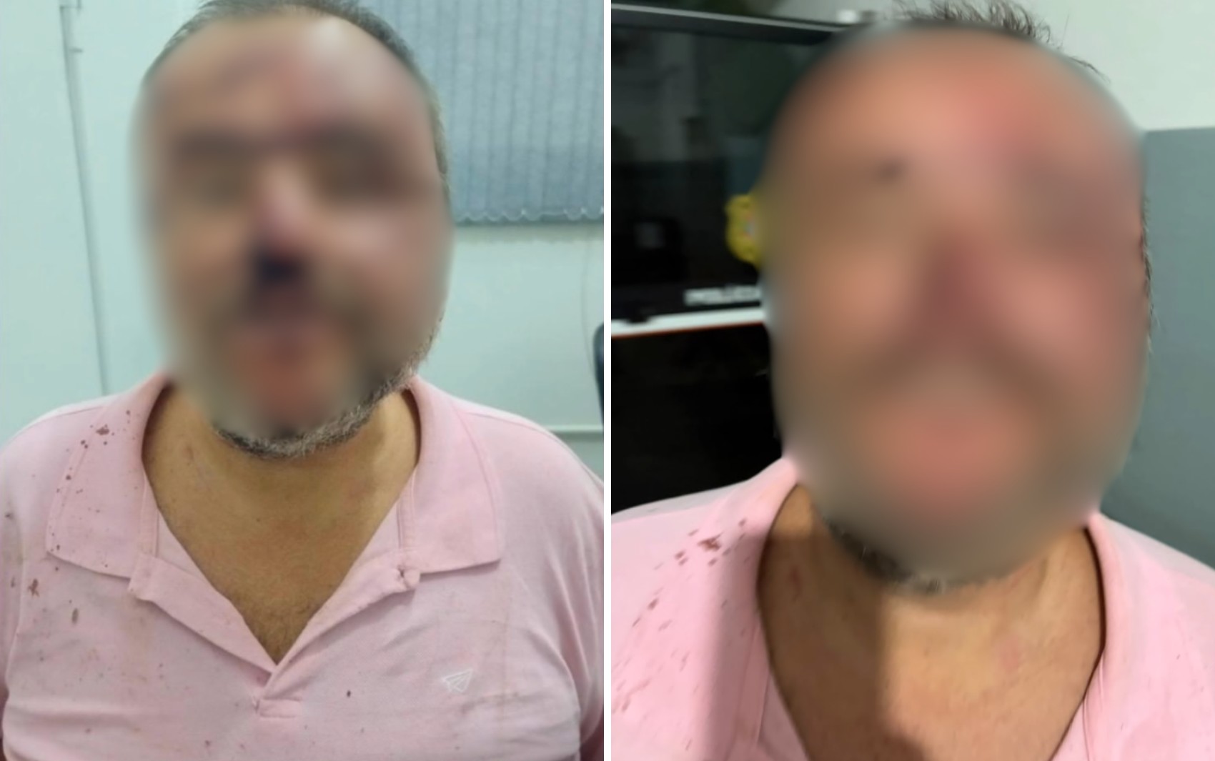 Advogado agredido diz que apresentou carteira digital da OAB, mas tenente da PM não acreditou: 'Falou que era IA'