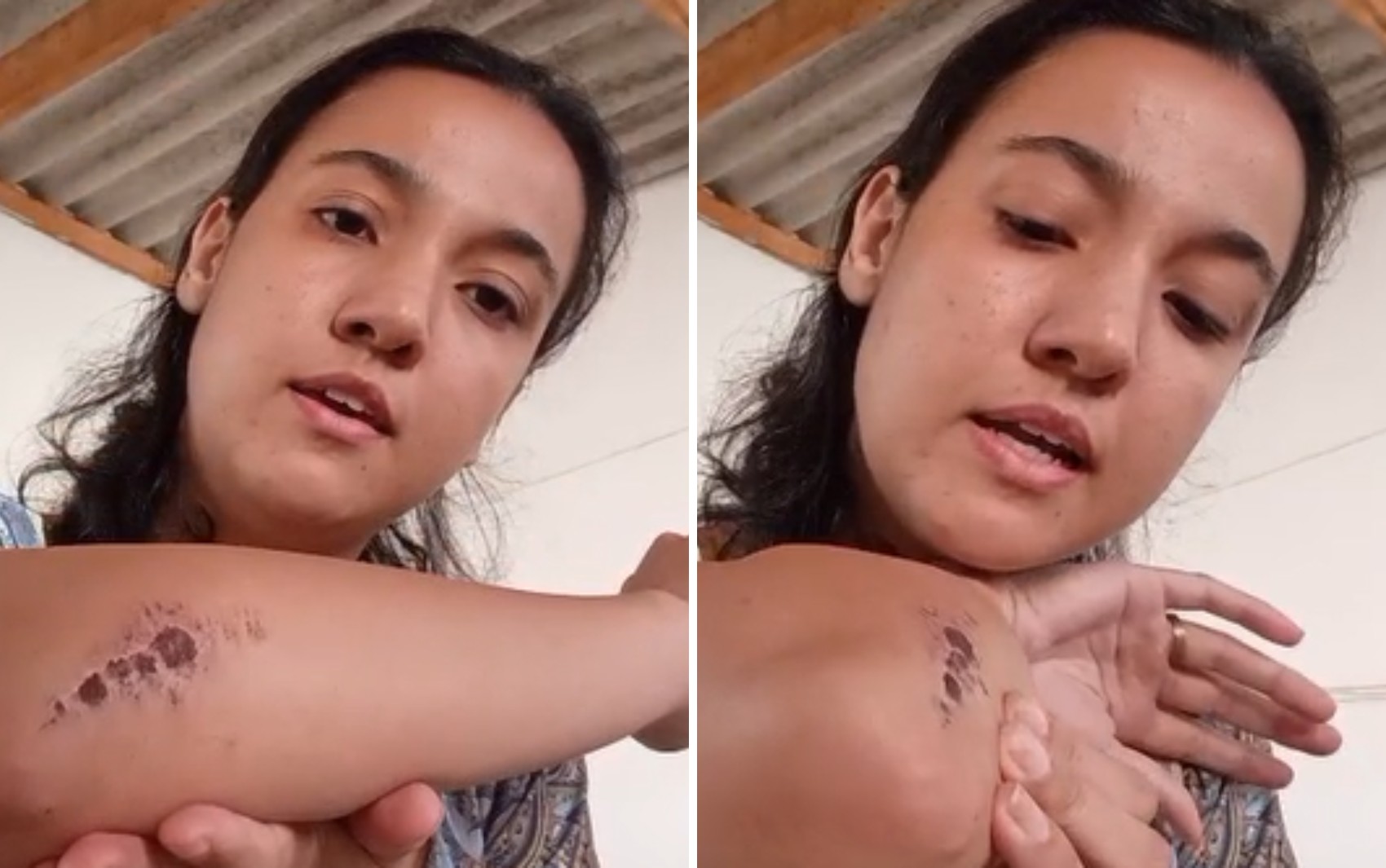 Mulher diz que foi atropelada por ex-sogro porque tentou retirar a cadeirinha da filha do carro