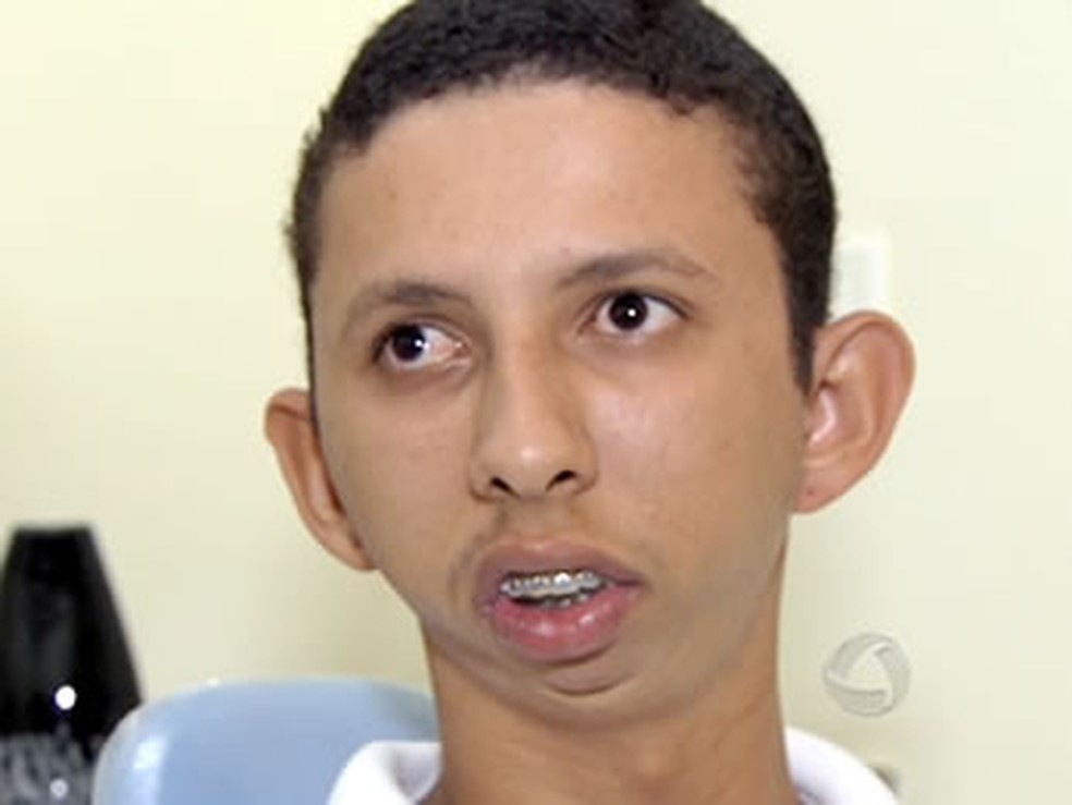Luiz nasceu de parto normal e o médico teria utilizado um 'forceps' — Foto: Reprodução/TVCA