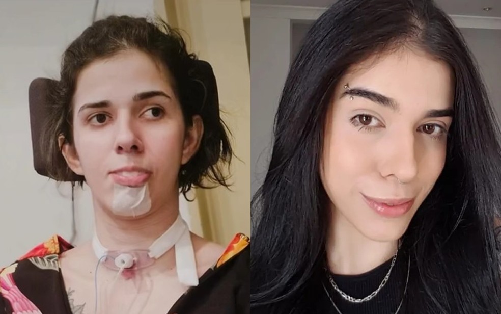 Thaís Medeiros de Oliveira convive há três anos com sequelas depois que teve grave reação alérgica ao cheirar pimenta — Foto: Reprodução/ Perfil do Instagram de Thaís Medeiros e Arquivo pessoal/Matheus Lopes de Oliveira