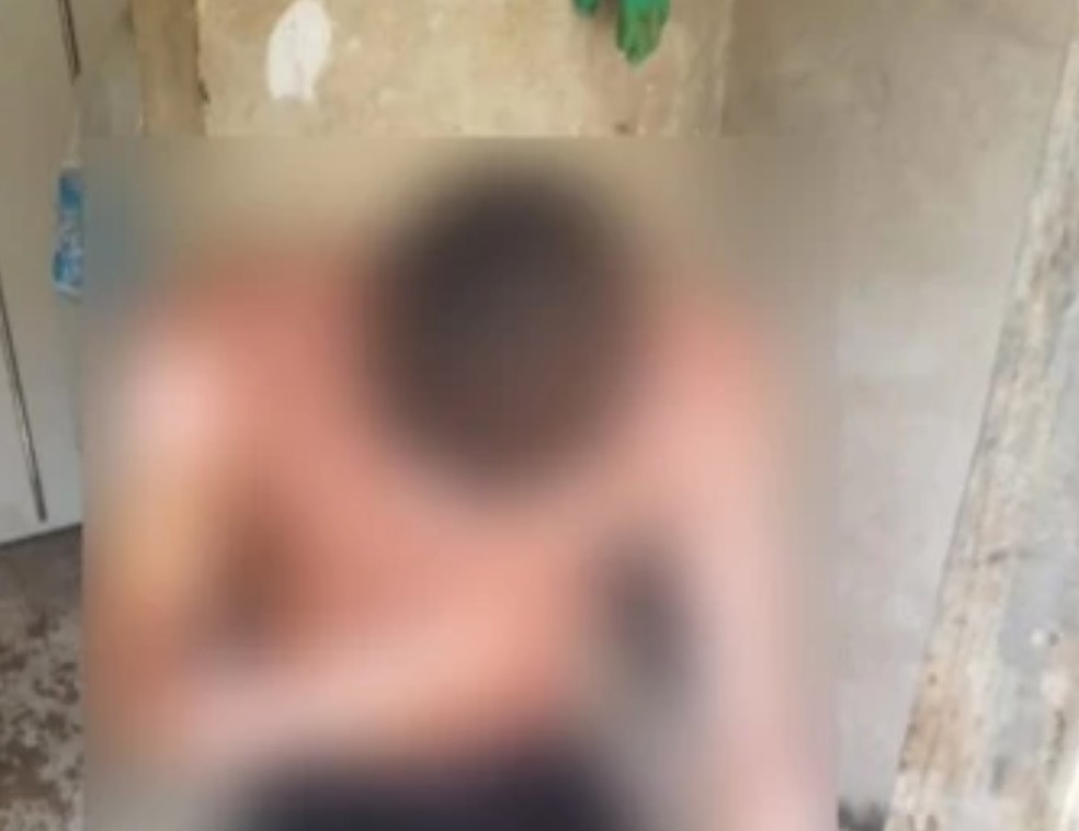 Mulher é suspeita de atear fogo no ex-namorado após ser agredida em São Luís — Foto: Reprodução/Redes Sociais