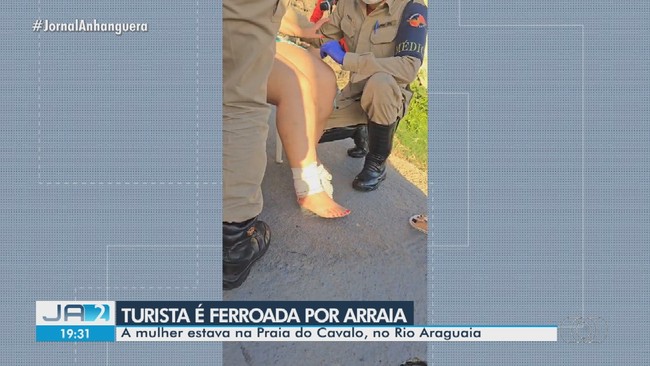 Turista  levada para o hospital aps ser ferroada por arraia