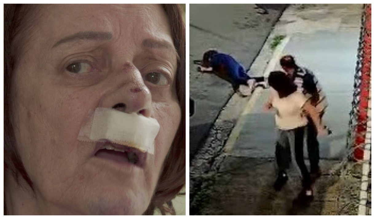 Após reclamar de latidos de cachorro, idosa é agredida por mulher, jogada no chão e quebra os dentes no interior de SP 