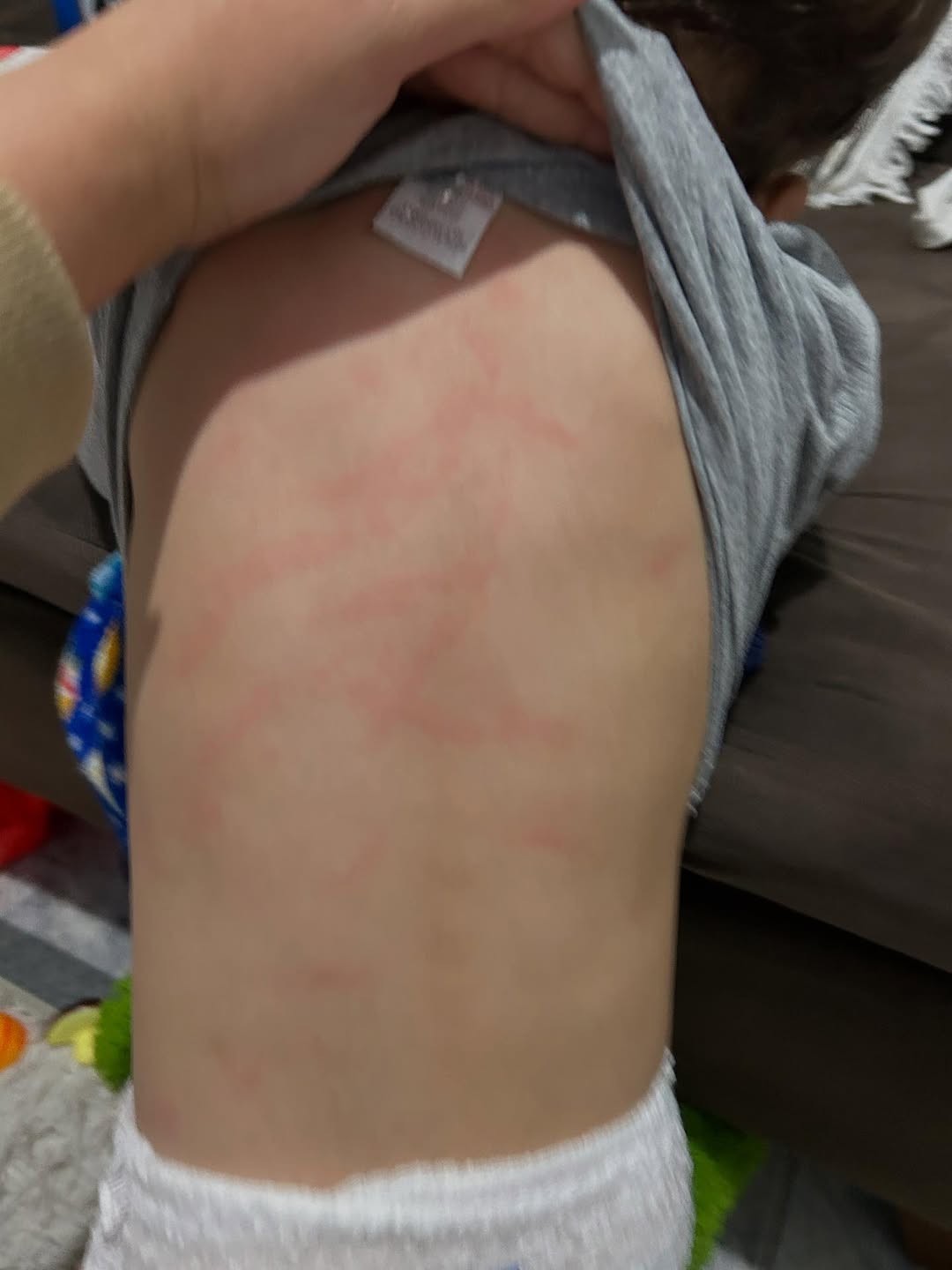 Mãe denuncia agressão contra filho de 1 ano dentro de creche em Juiz de Fora; polícia investiga o caso