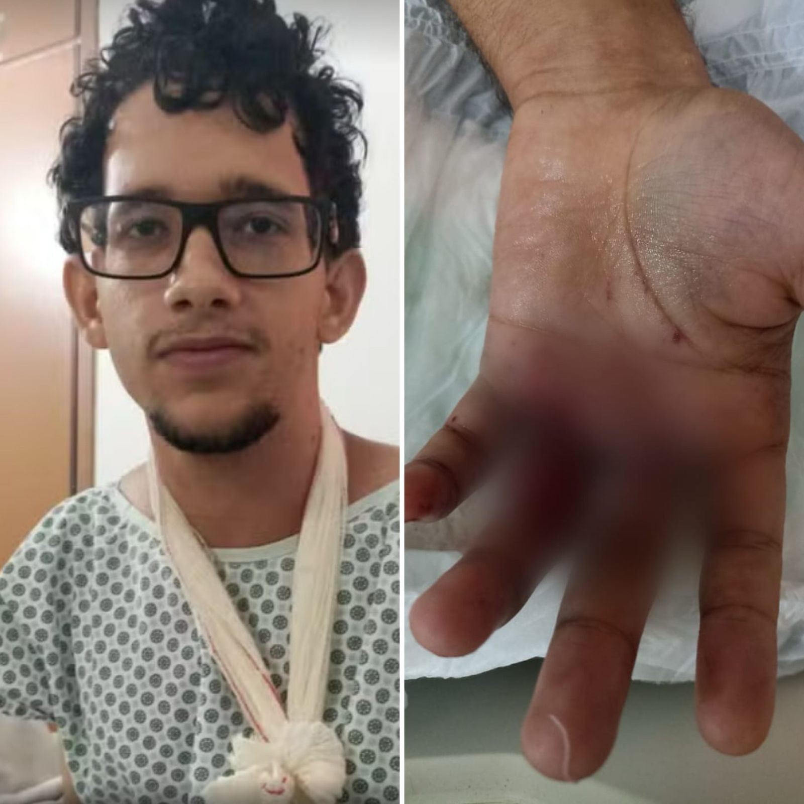 Bombinha 'surpresa' e investigação: o que se sabe sobre explosão de bolo que deixou jovem ferido em festa de aniversário