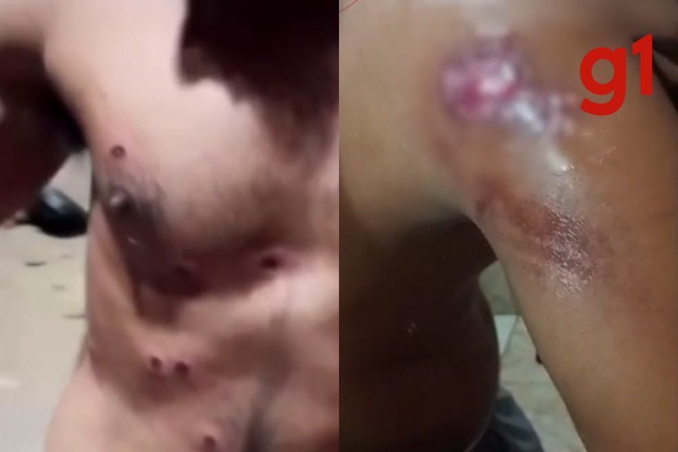 Trabalhadores ficaram feridos durante protesto — Foto: MTE