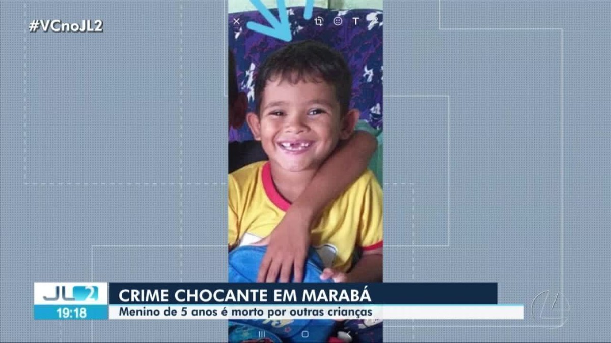 Criança de Vila Nova do PI, de 11 anos, morre após complicações da