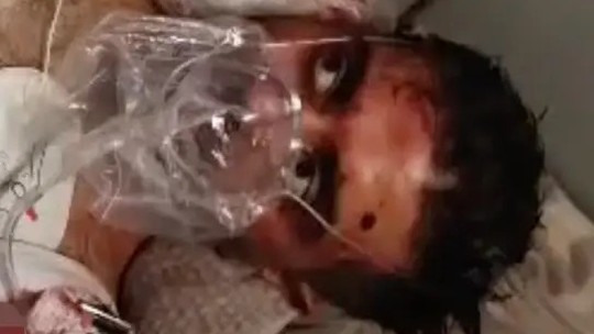 'Se eu não levantasse, os passageiros morreriam', diz piloto esfaqueado