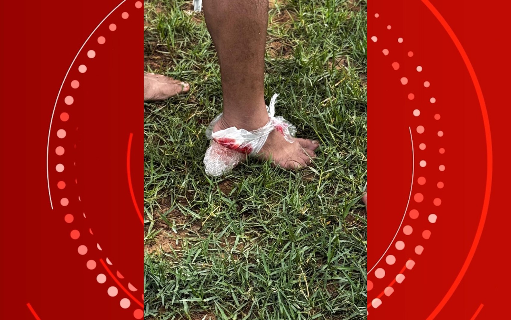 Ataque de piranhas deixa cinco pessoas feridas em rio no interior da Bahia