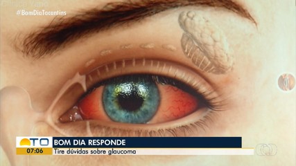 Entenda sobre glaucoma no Bom Dia Responde