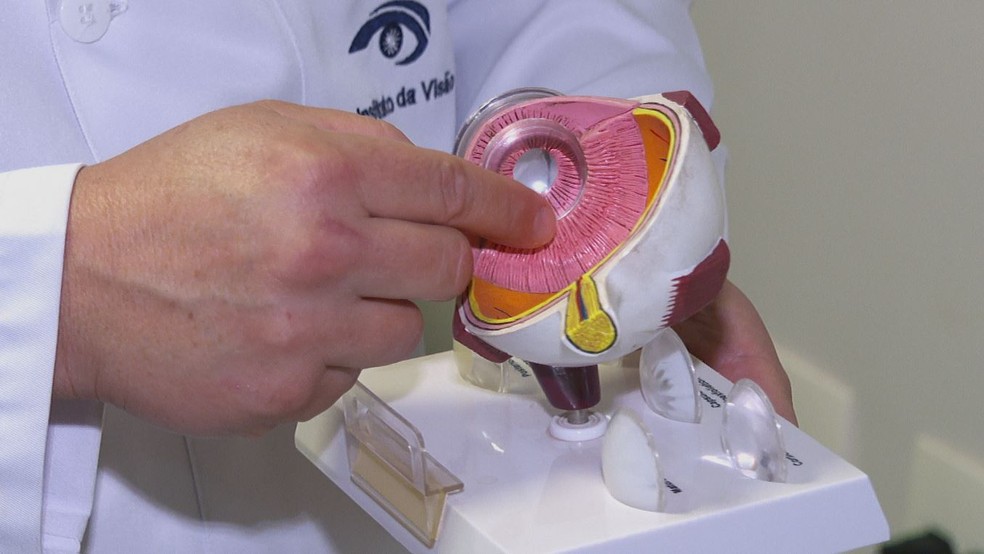 Cirurgia de catarata consiste em remover o cristalino opaco na parte interna do olho para implantar uma lente artificial e restabelecer a visão — Foto: Aurélio Sal/EPTV