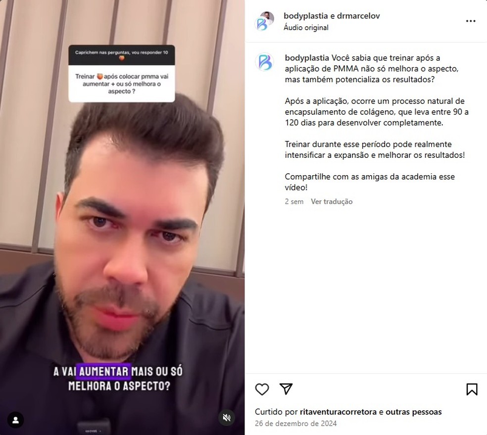 Post do médico Marcelo Vasconcelos no Instagram falando sobre a prática de exercícios após a aplicação do PMMA — Foto: Reprodução/Redes sociais
