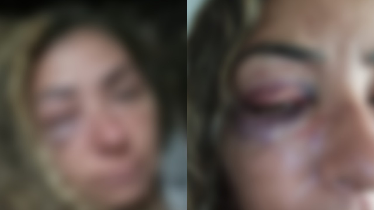 Mulher é agredida por segurança e dono de bar no interior de SP