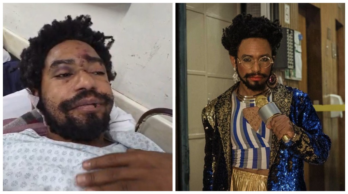 Ator montado de drag queen é espancado em adega no Centro de SP após ataque homofóbico
