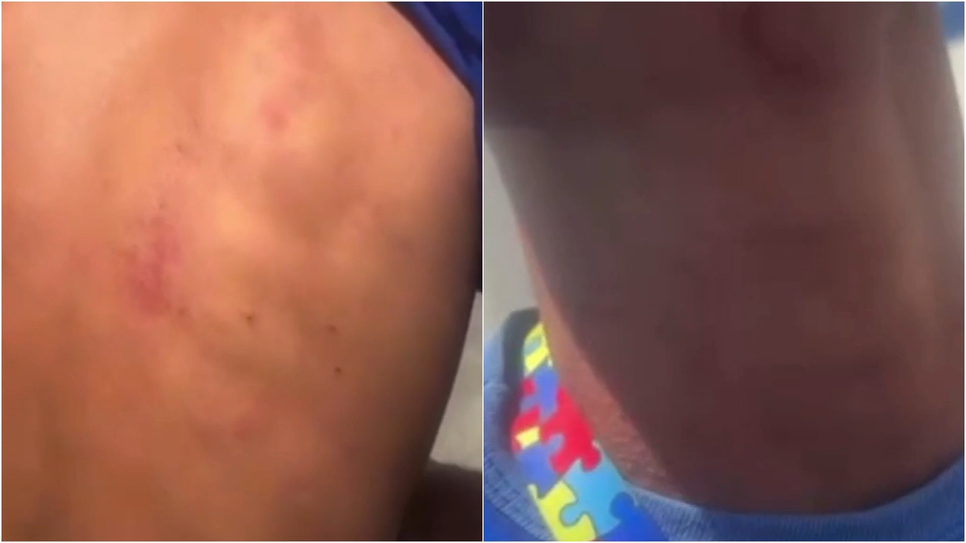 PM afasta policiais após abordagem a jovem autista no interior do RN