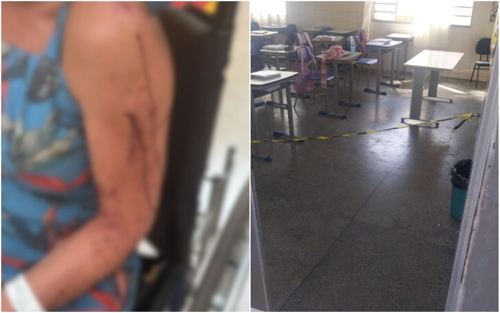 Professora denuncia ter sido esfaqueada por aluna em escola de Goiás