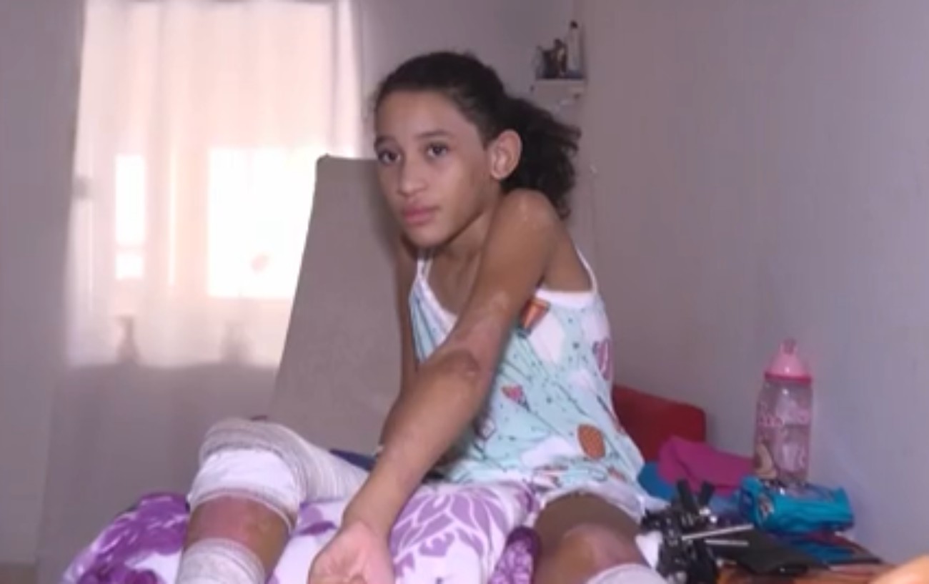 Única sobrevivente de explosão na Bahia enfrenta nova fase da recuperação após alta médica