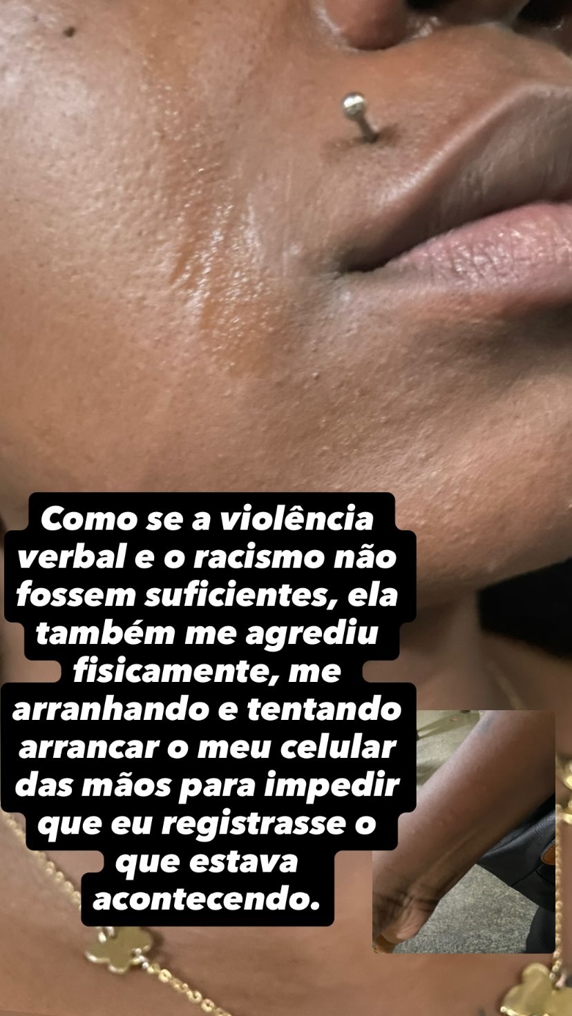 Modelo denuncia ter sido chamada de ‘macaca’ e ‘favelada’ ao entrar em elevador cheio no Centro do Rio 