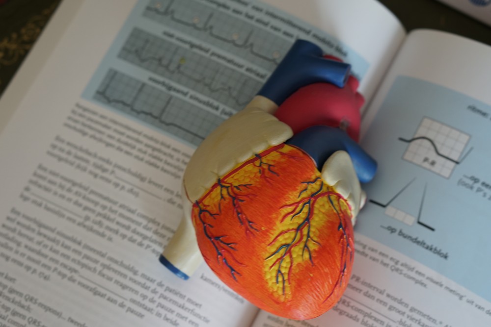 Diretrizes médicas recomendam que todos os adultos meçam a lipoproteína(a) ao menos uma vez na vida