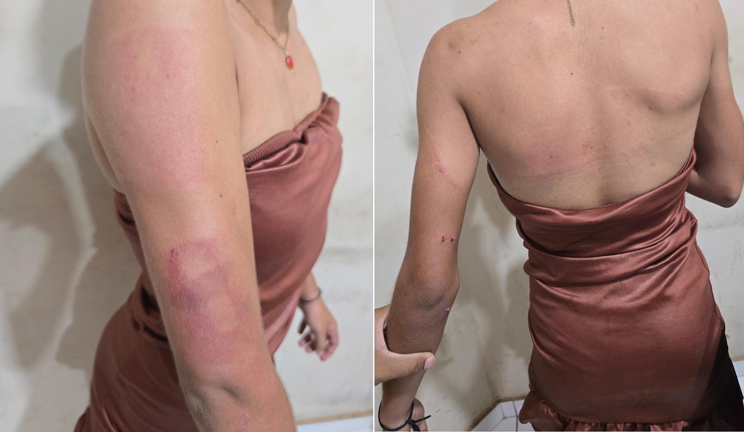 Homem é preso suspeito de agredir irmã adolescente com pedaço de madeira no Pará