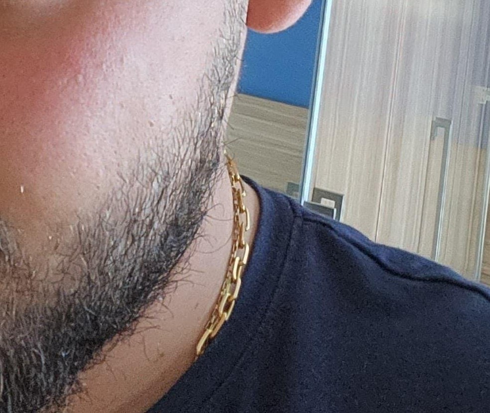 Correntinha roubada por assaltante em Belo Horizonte  — Foto: Arquivo Pessoal