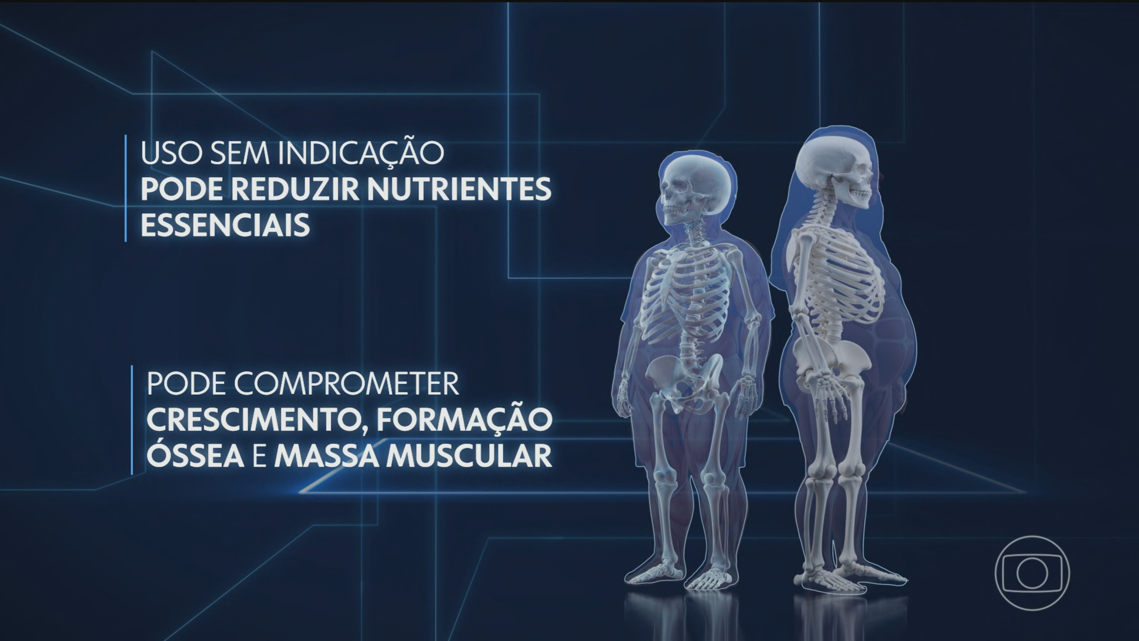 Uso indiscriminado de canetas emagrecedoras por jovens preocupa médicos no Brasil